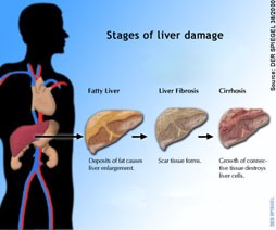 wake gastro management of liver disease