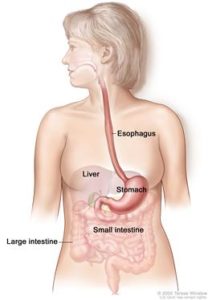Wake Gastro Digestive Cancer Screening